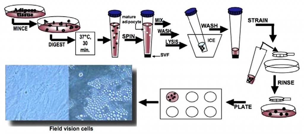 adsc_differentiation_1