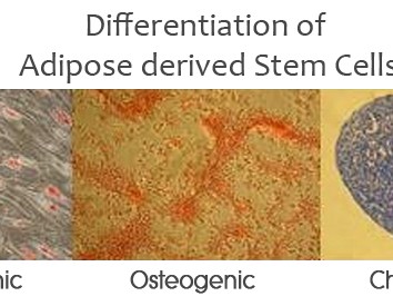 脂肪由来幹細胞：単離、拡大および分化