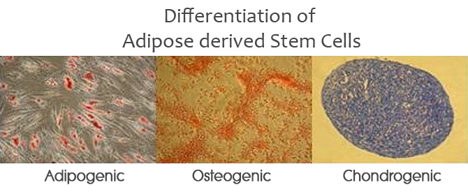 adsc_differentiation_2