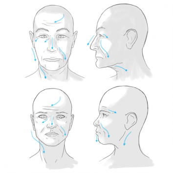 顔の浮腫が老眼を作る。