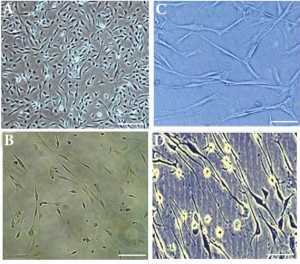 Differentiation potential of ADSC into neuron cells