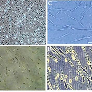 Differentiation potential of ADSC into neuron cells