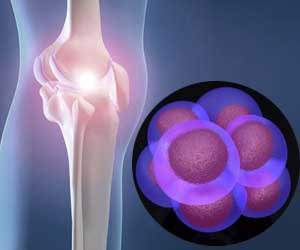 stemcell_knee_01