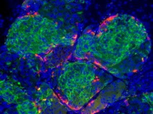 糖尿病のための胚性幹細胞の研究