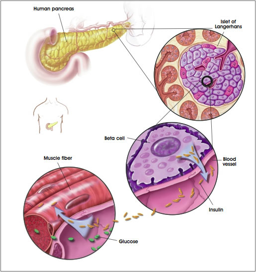 diabetes_pancreas