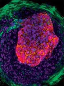 幹細胞は、小さな心臓の鼓動を作成します。